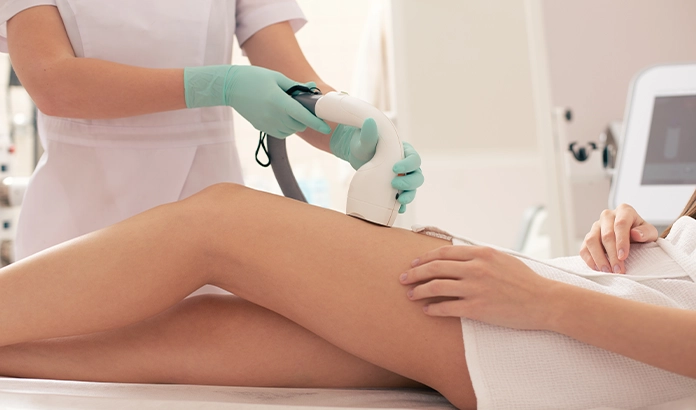 lazer epilasyon ne zaman yapılır?